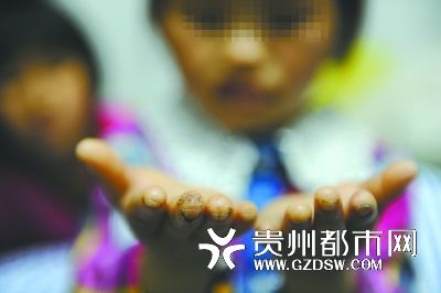 指尖被針扎得傷痕累累。