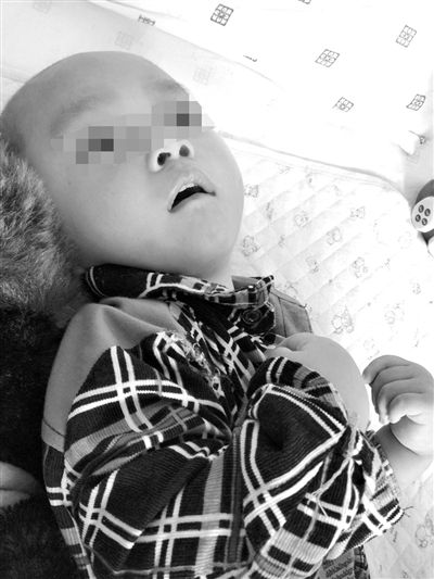 9月10日，陳揚(yáng)躺在醫(yī)院的病床上，他的眼睛仍然沒(méi)有聚焦感。新京報(bào)記者 朱柳笛 攝