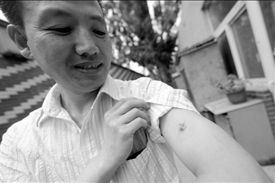 郭學(xué)江制服狂徒時(shí)被咬傷。京華時(shí)報(bào)記者潘之望攝