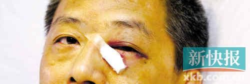 ■這起醫(yī)鬧事件，受傷的遠(yuǎn)遠(yuǎn)不只是熊旭明醫(yī)生的身體。