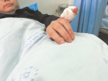 實(shí)習(xí)醫(yī)生陳洪左手的小拇指肌腱斷裂。