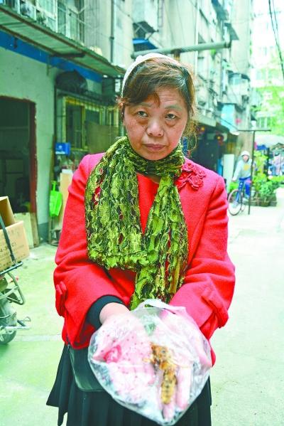 頭部受傷的黃女士展示兩根大魚刺。