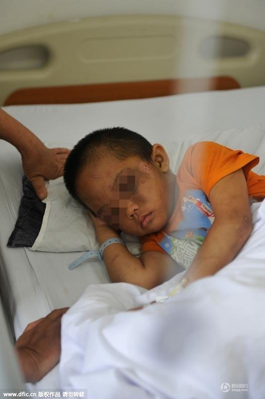 圖為全身傷痕累累的小進。