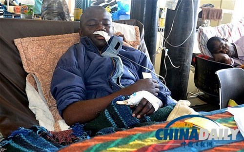 雖然已經(jīng)在醫(yī)院接受了近一個月的恢復(fù)治療，卡托卡的身體仍然非常虛弱。