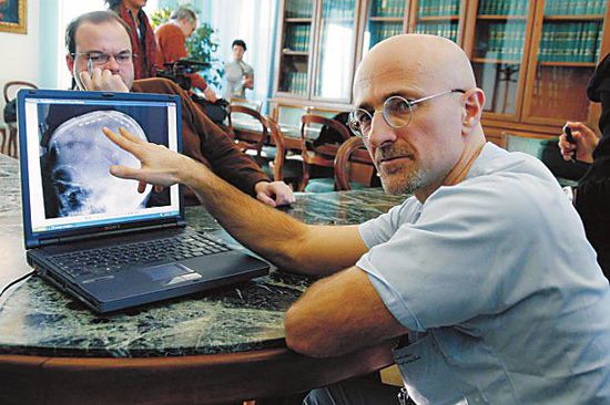 圖為卡納維洛醫(yī)生，不少人認(rèn)為他的想法非常瘋狂