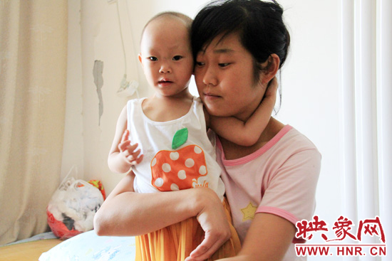 孩子和媽媽在一起，她的右眼已經(jīng)失明。