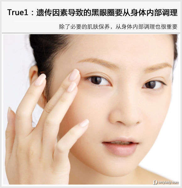 遺傳因素導致的黑眼圈要從身體內(nèi)部調(diào)理