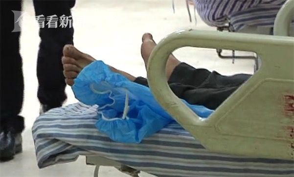 黃鱔從肛門(mén)鉆進(jìn)肚子 男子被送醫(yī)不愿多談事情經(jīng)過(guò)