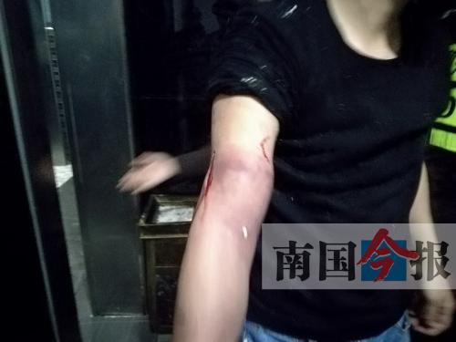 覃先生手臂被卡的部位受傷流血，所幸傷勢無大礙。 通訊員 王建民 攝