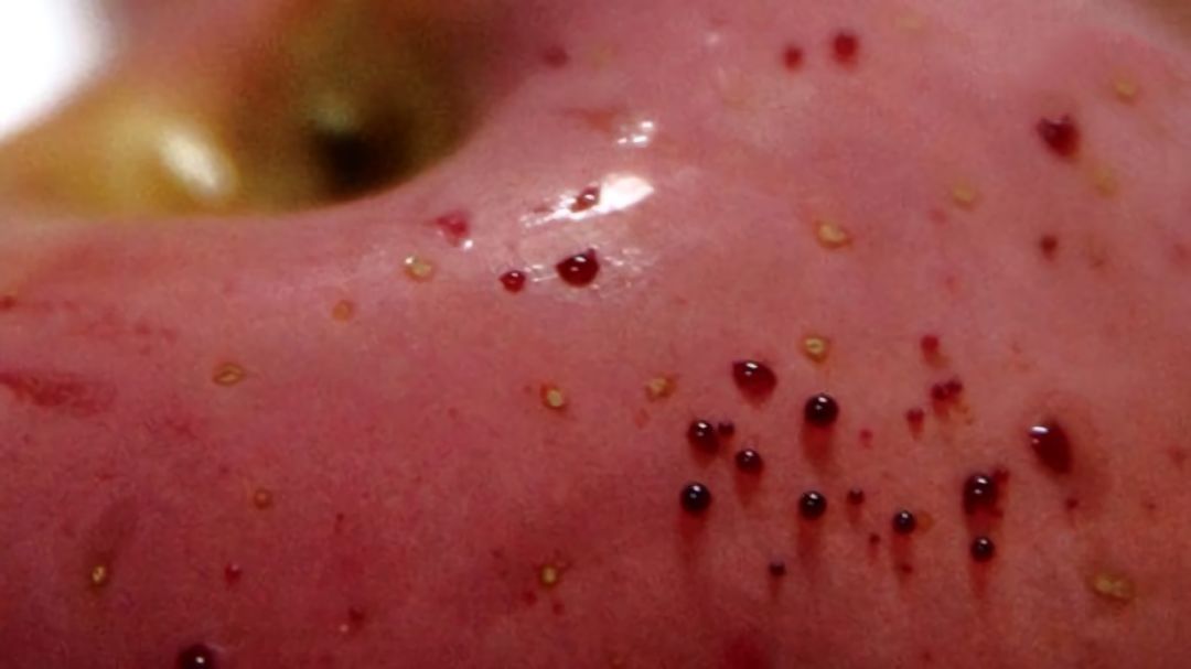 嚇懵！女子用熱水泡蘋果結(jié)果冒出血珠 咋回事？