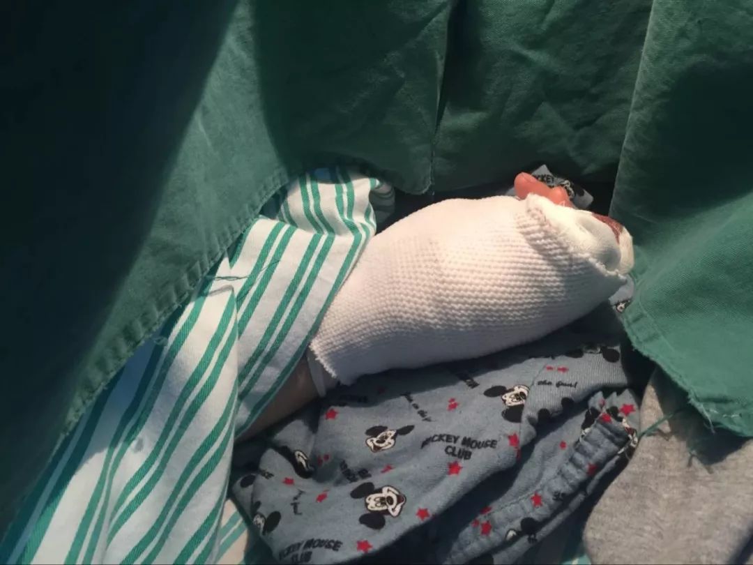 嚇哭！6歲男孩被夾斷手指 罪魁禍?zhǔn)拙故切７? oldsrc=