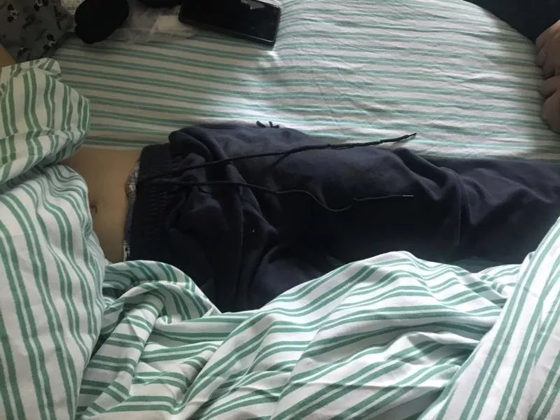 嚇哭！6歲男孩被夾斷手指 罪魁禍?zhǔn)拙故切７? oldsrc=