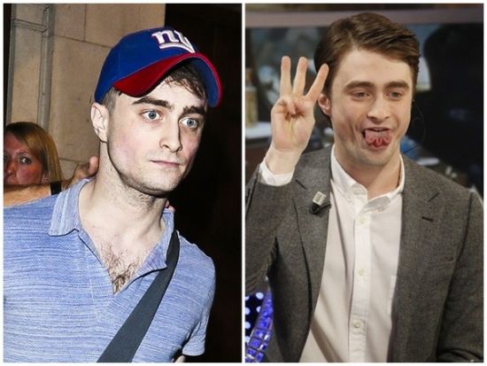 丹尼爾日前被拍到骨瘦如柴，不似2月份健康