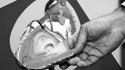 威廉斯領(lǐng)導(dǎo)的研究團(tuán)隊(duì)已經(jīng)利用人體脂肪干細(xì)胞，成功3D打印出心臟血管和心臟瓣膜，待一顆心臟的所有部件打