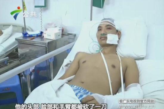 另一名傷者頭部、臉部和手臂都被砍了一刀。(視頻截圖)