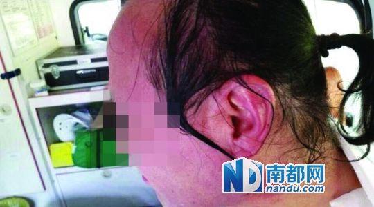 涉事教師遭熱水潑臉后的照片。