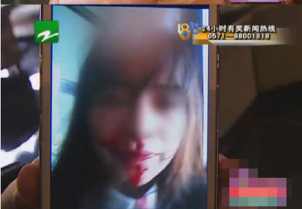 24歲女大學生被包養(yǎng) 意外懷孕遭對方帶人圍毆