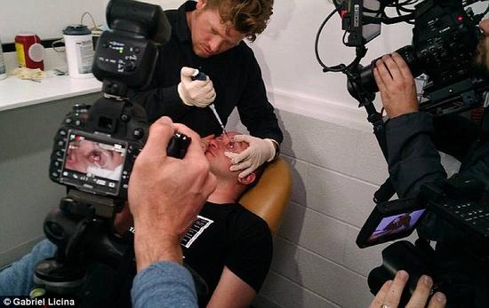 該實驗是由加州一支名為“生物駭客”的實驗團隊開展的。他們使用了一種名為二氫卟吩e6（Ce6）的物質(zhì)的溶液。Ce6常見于深海魚體內(nèi)，有光敏特性，通常用于癌癥治療研究中。研究團隊將Ce6與胰島素和鹽水混合起來，得到一種溶液，可以在低光照條件下提高人類的視力。