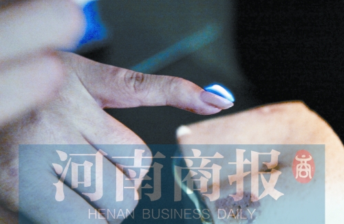 將指甲油涂在指甲上，靠近火焰時被引燃了