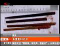 男子胃疼做手術 胃中取出八根筷子