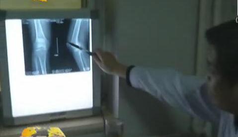 冷空氣來襲 如何預(yù)防老寒腿？